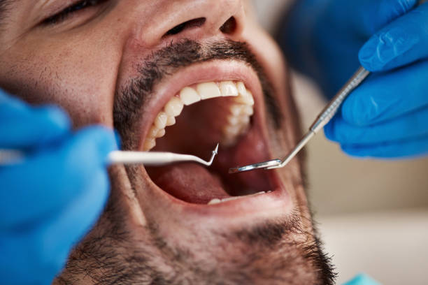 Best Tooth Infection Emergency Dentist  in English Creek, NJ